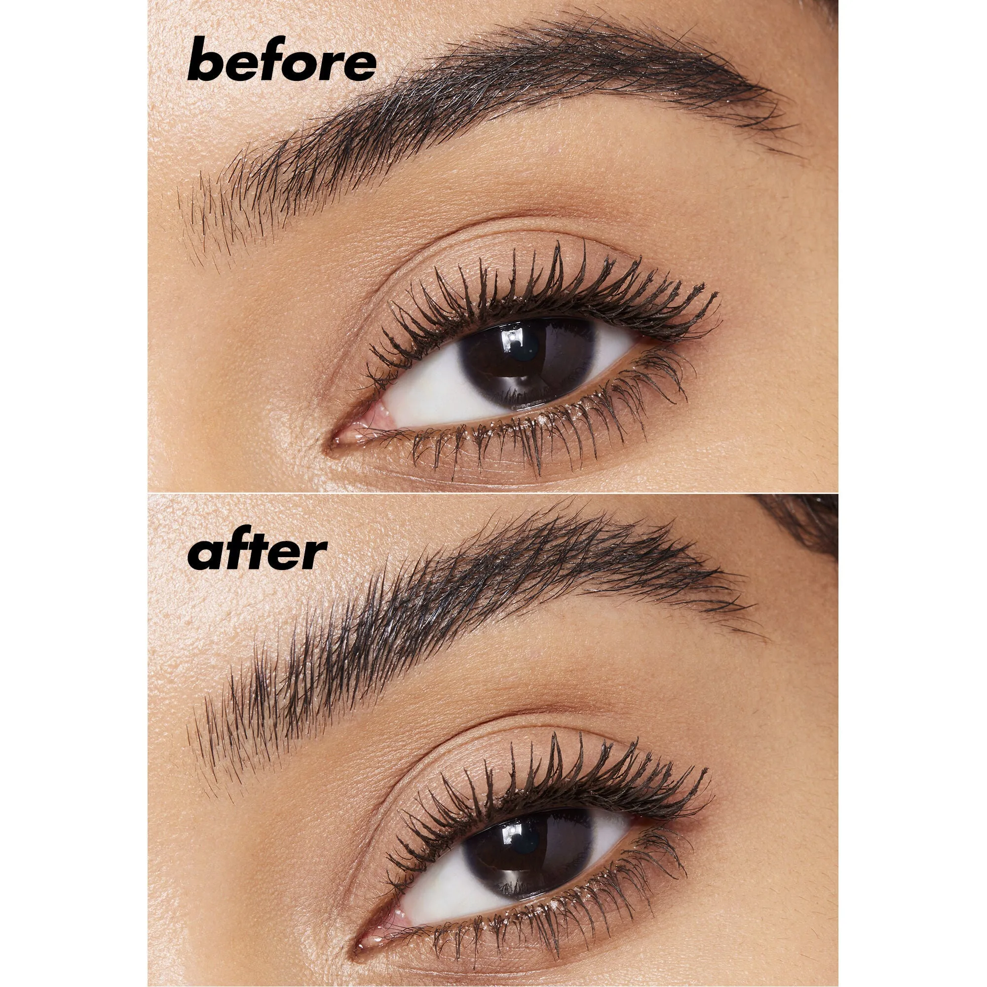 Brow Lift